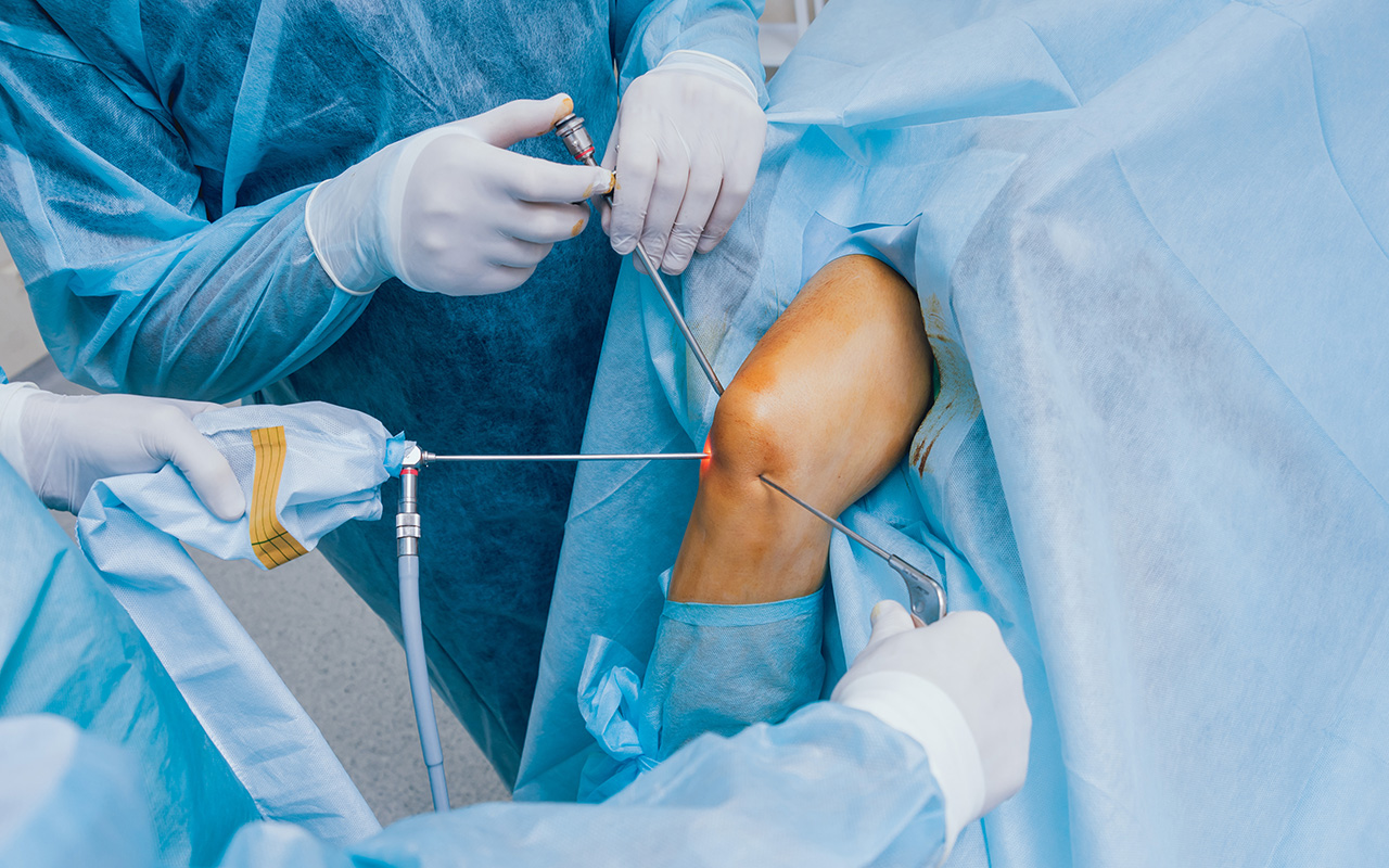 Knee Arthroscopy Dr Nabeel Mahomed